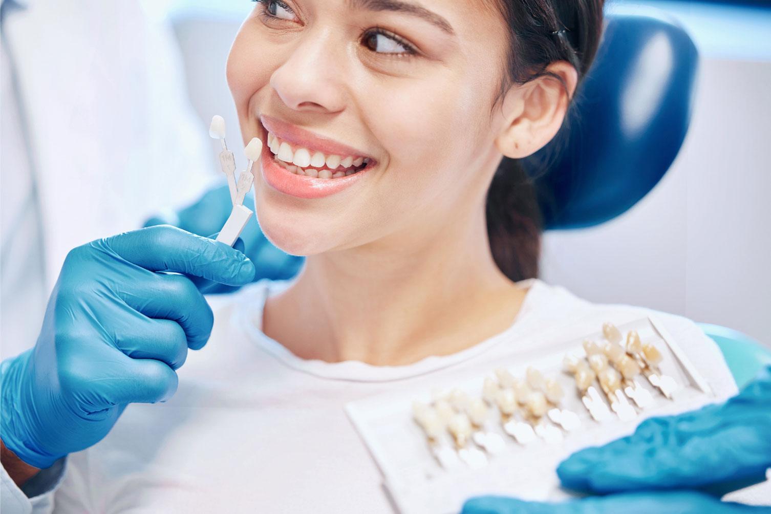 dental veneers in Carlsbad