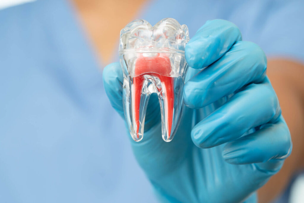 Root Canal in Carlsbad California – Smiles For Health dental clinic Near San Marcos, Oceanside, Winter Warm, Farr, Fallbrooks, San Diego, Solana, Pala Mesa, Leucadia, Mira Costa, Vista, Fairbanks, Carlsbad Village, Hidden Meadows