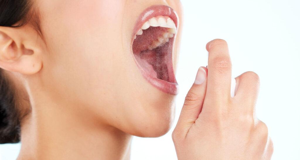 Stress and Oral Health: Dry Mouth, Decay, and Bad Breath Explained