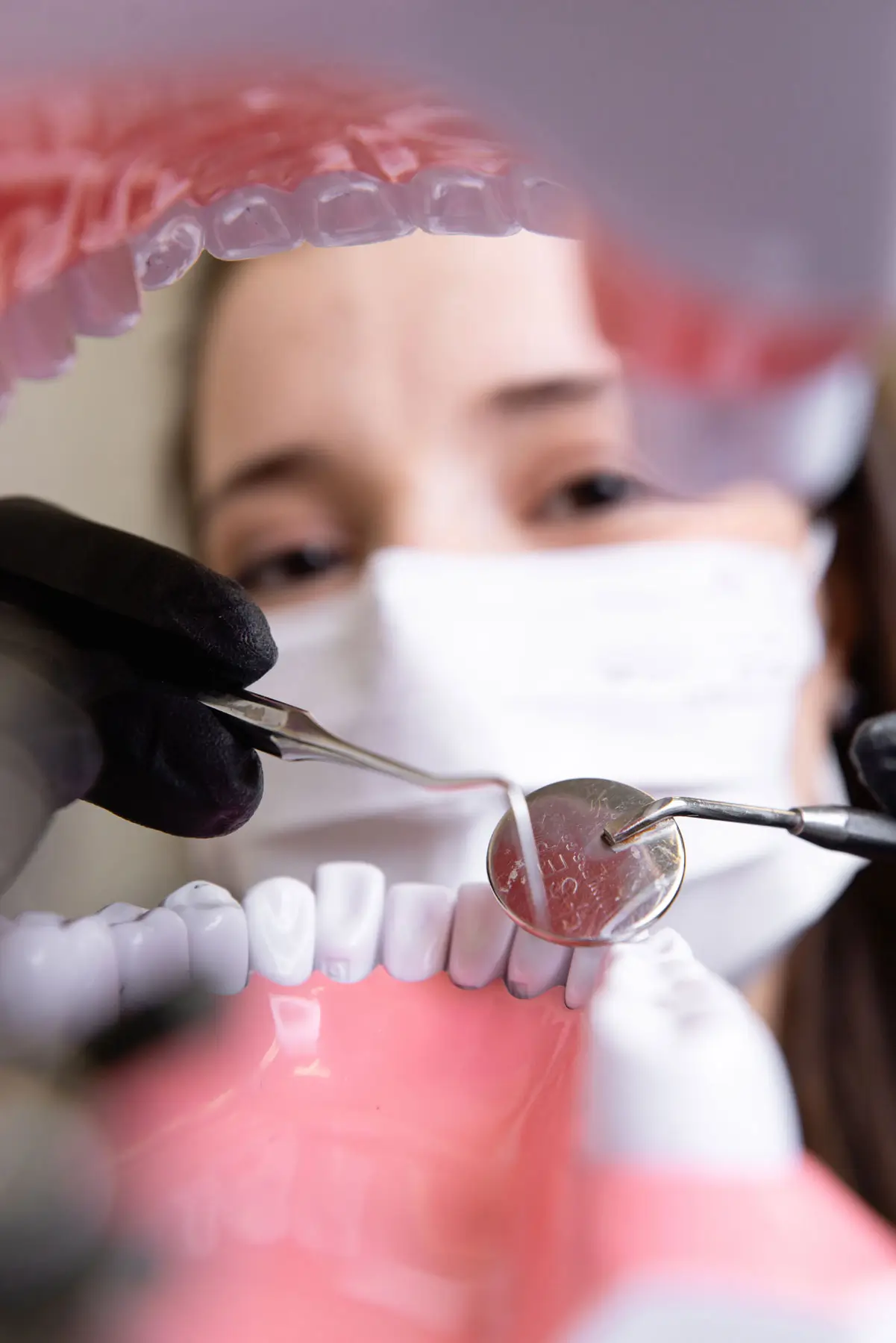 When fluoride treatment in Carlsbad helps most