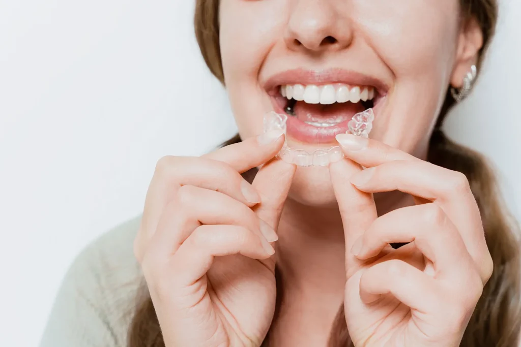 Clear Aligners and Wellness Approach
