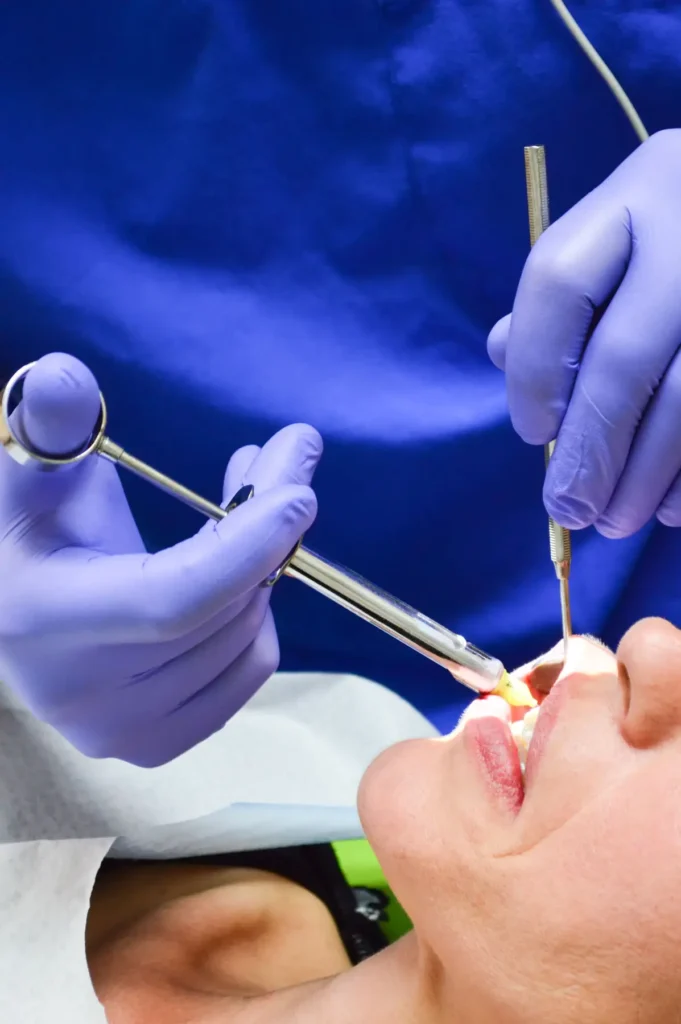 Dental Extractions in Carlsbad