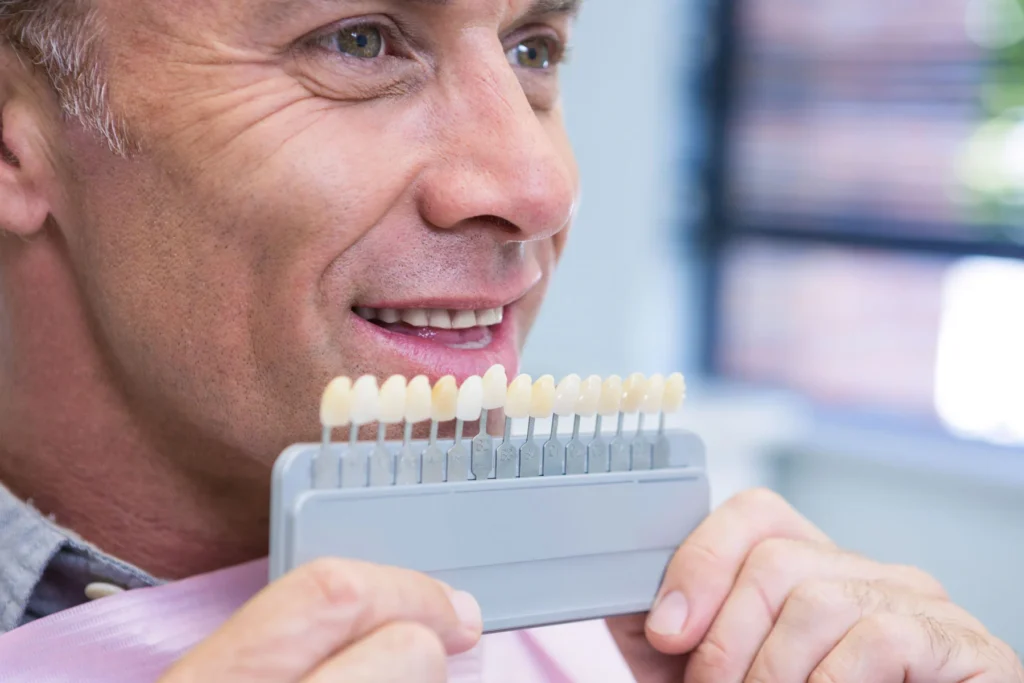 Equipment For Veneers