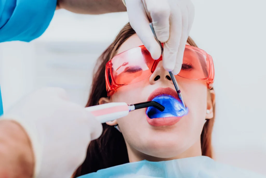 Maintaining Your Bonded Smile in Carlsbad