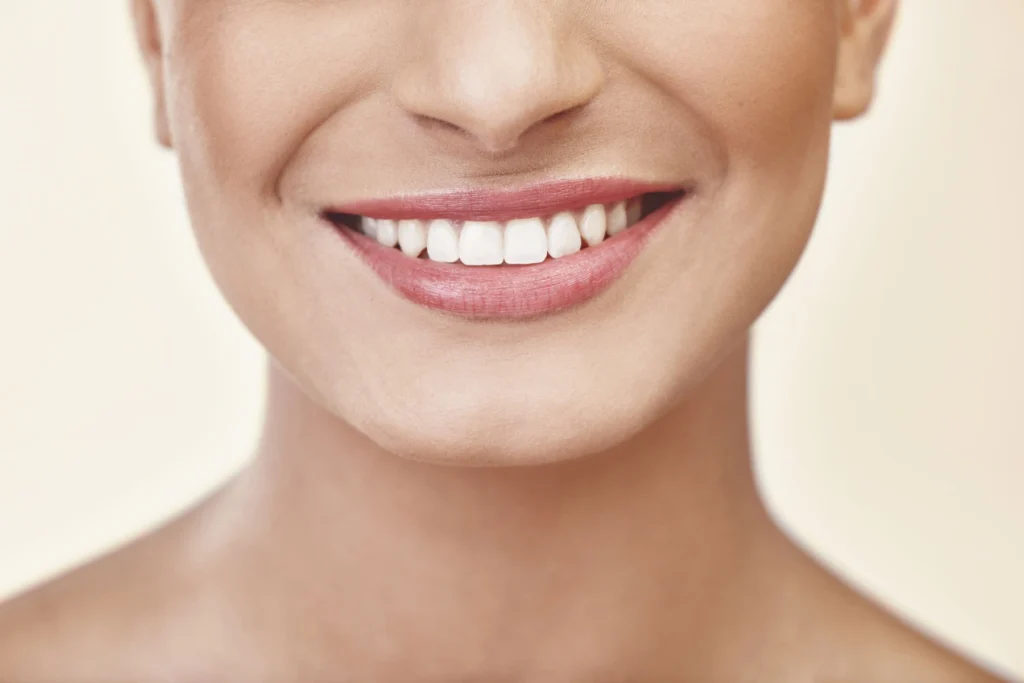 Smile Makeover Procedures Carlsbad