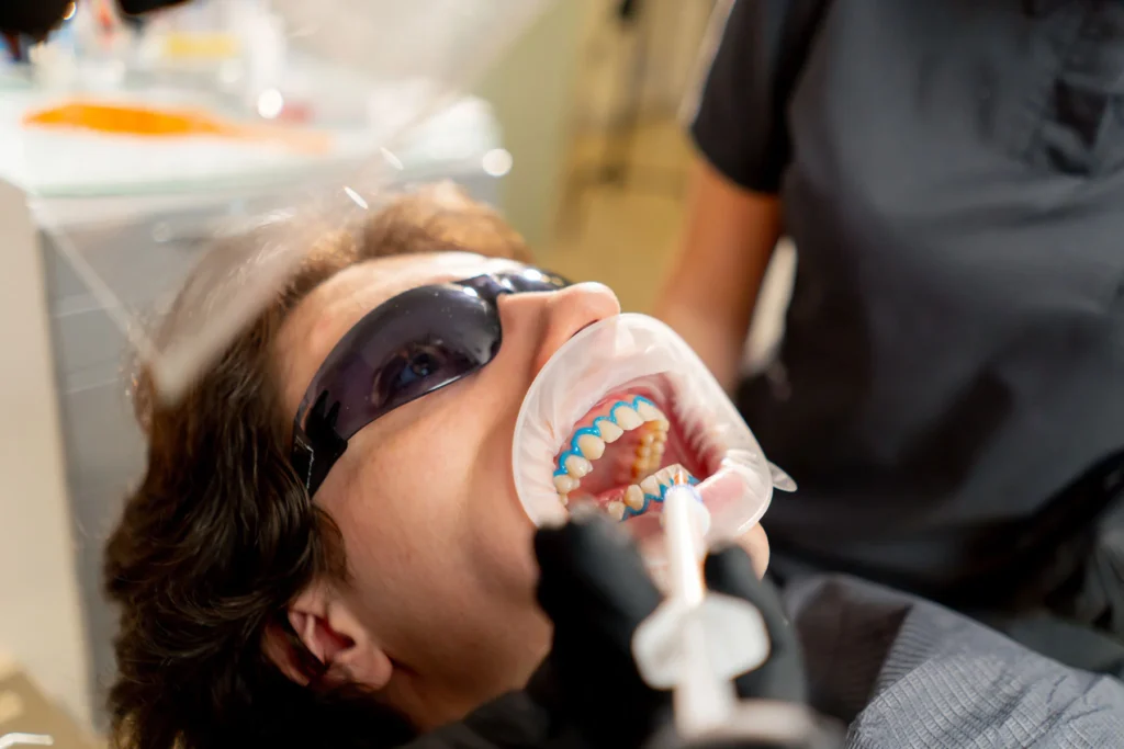 Key Benefits of Professional Teeth Whitening in Carlsbad
