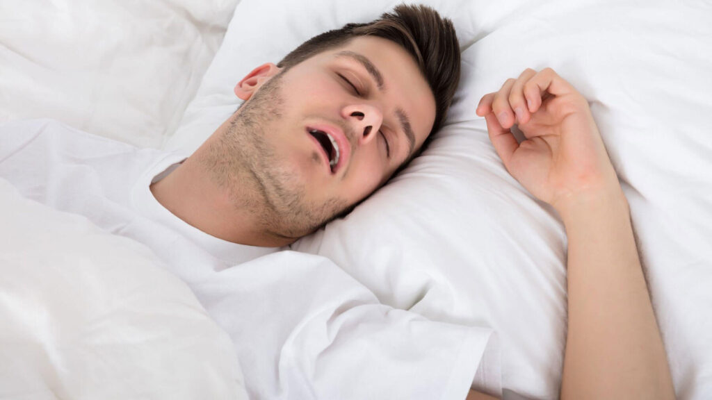 Snoring for Sleep Apnea