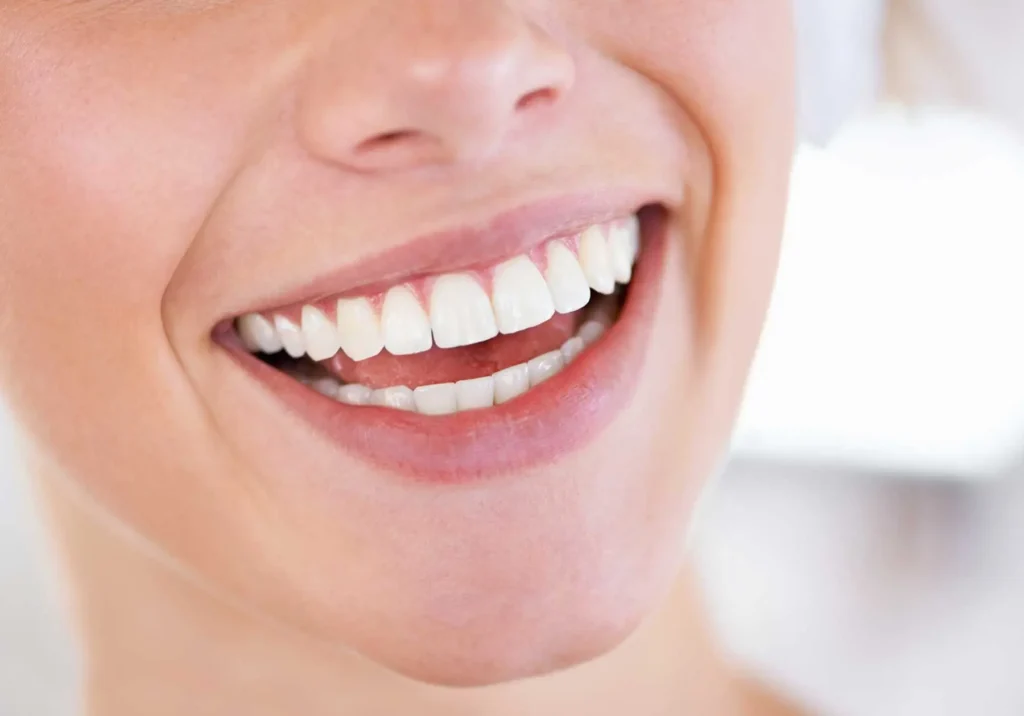 Cosmetic-Dental-Treatment-In-Carlsbad