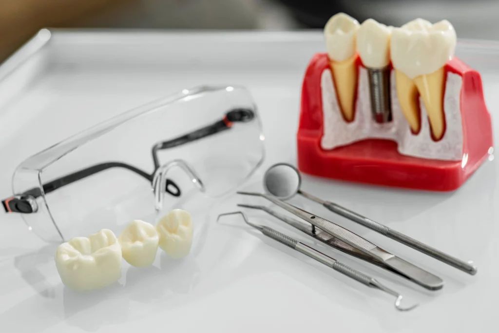 Dental Bridge in Carlsbad