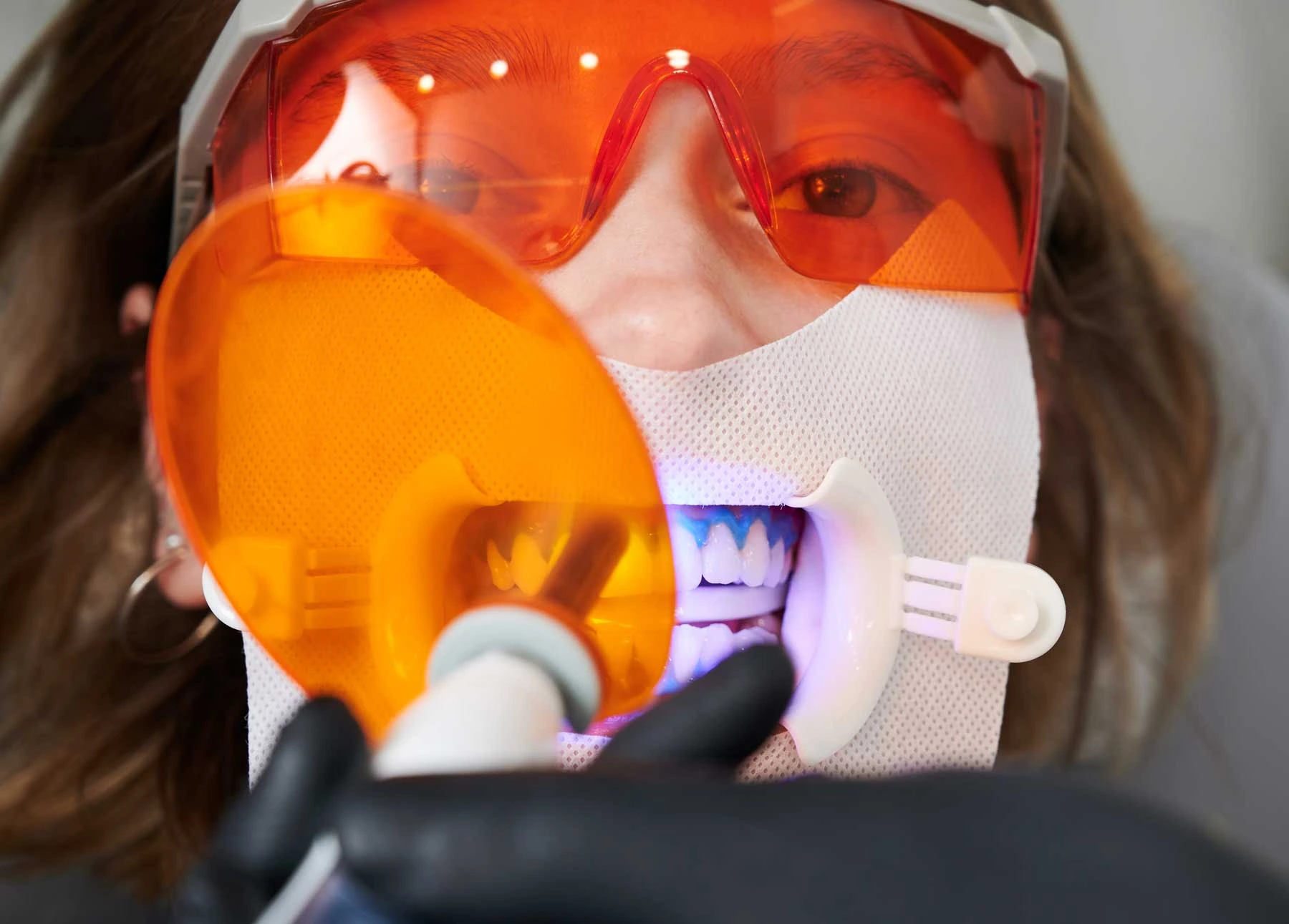 A-Brighter-Smile-with-Teeth-Whitening