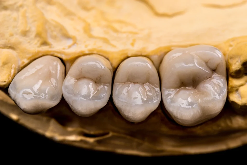 How a Filling Helps a Decaying Tooth