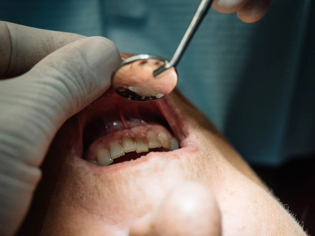 Symptoms That May Point to Tooth Decay