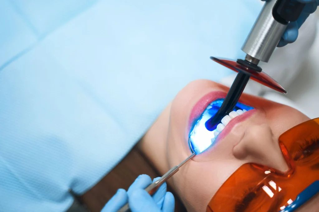 The Smiles for Health Experience for Dental Bonding Patients