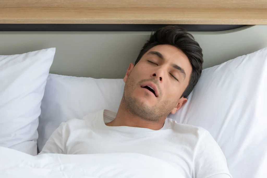 Dry-Mouth-for-Snoring