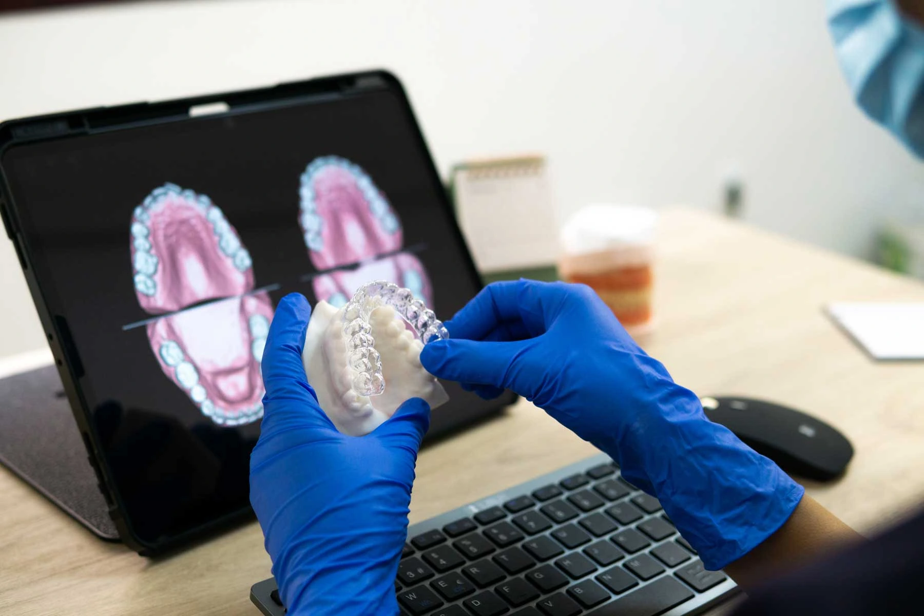 How-Teeth-Move-with-Clear-Aligners