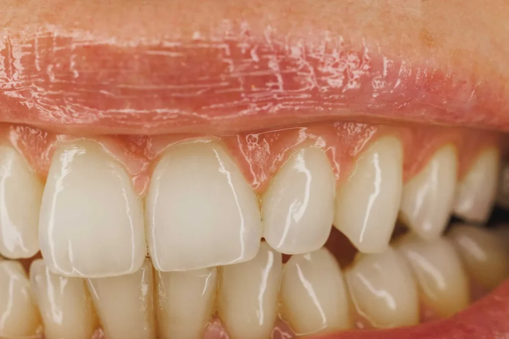 Oral-Health-After-40-Why-Your-Routine-Should-Change