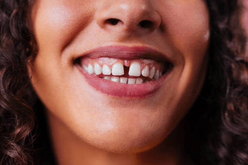 Different Smile for Dental Care