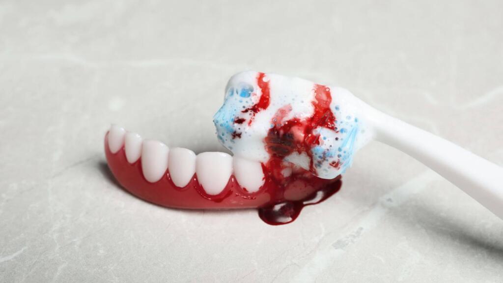 How Long to Keep Gauze In After Tooth Extraction