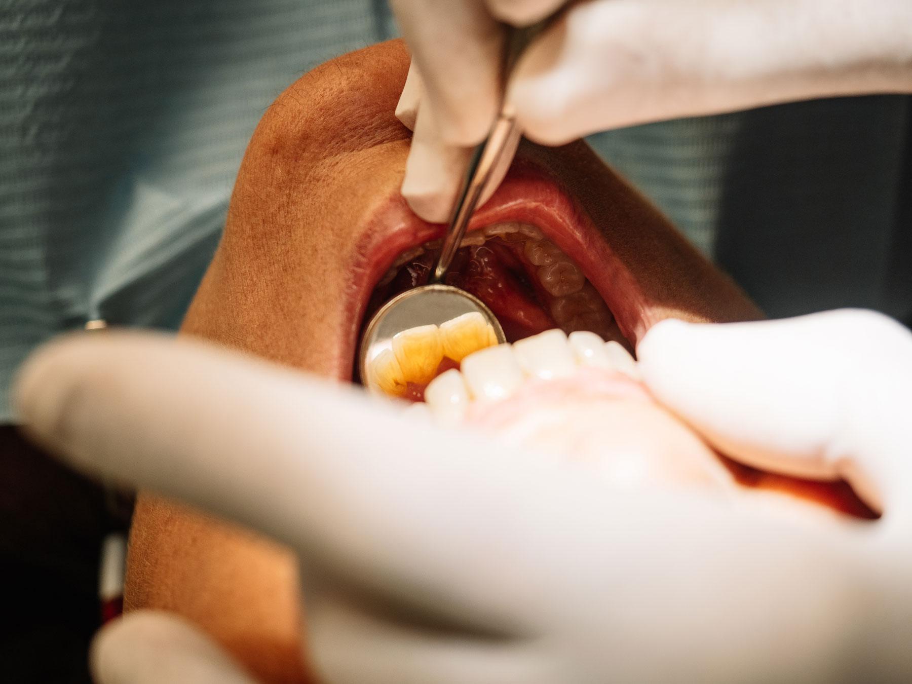 Dentist Carlsbad - Smiles For Health