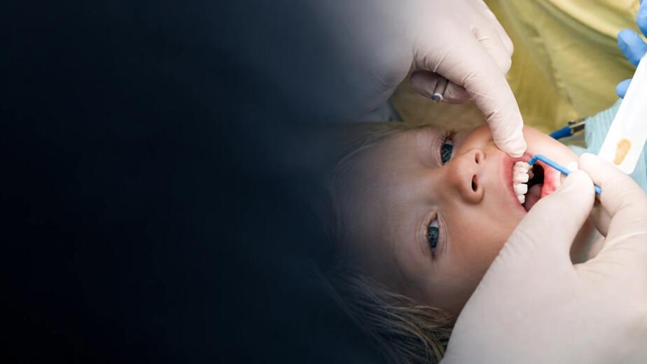 Fluoride treatment in Carlsbad