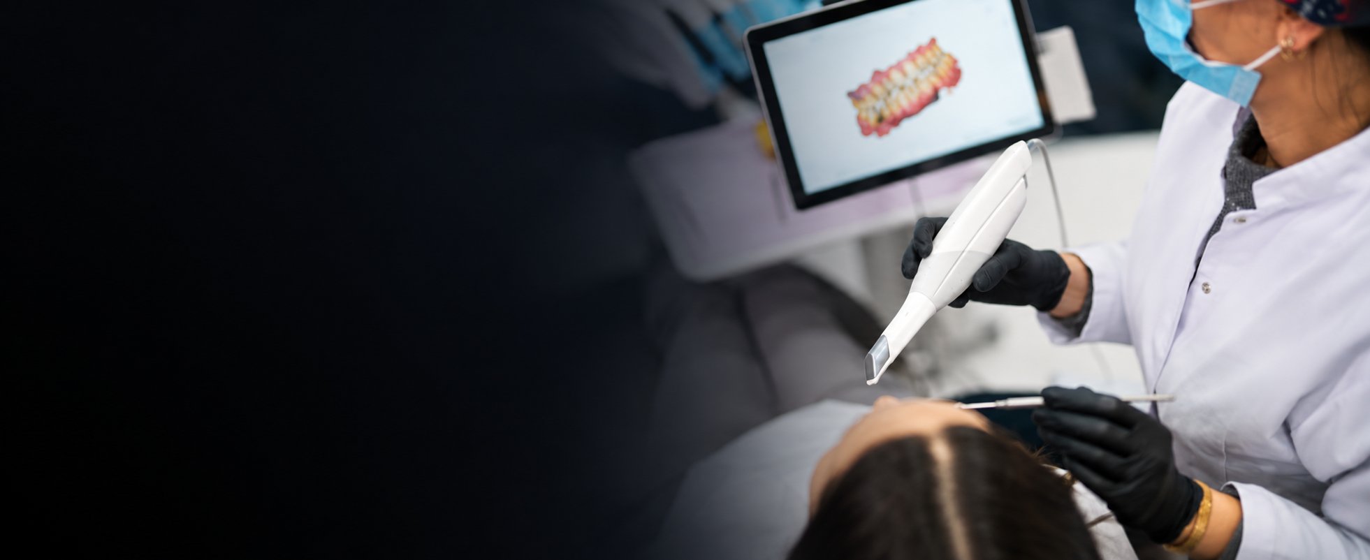 Oral cancer screening in Carlsbad